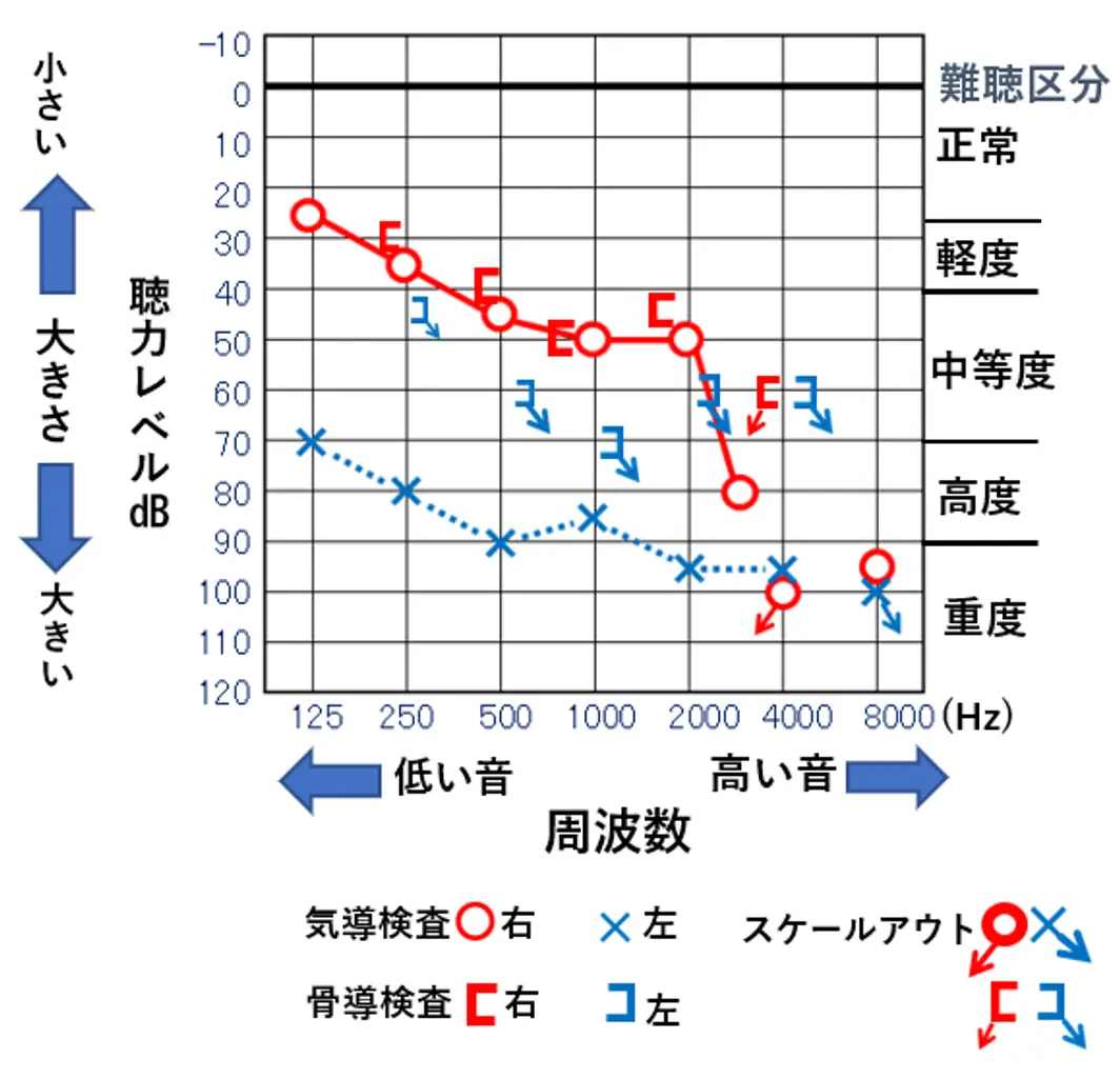 自分の聴力を知る！ ～オージオグラムを理解しよう～