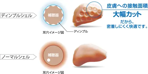 リサウンド耳あな型補聴器 オリジナルの工夫